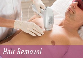 hair removal cda