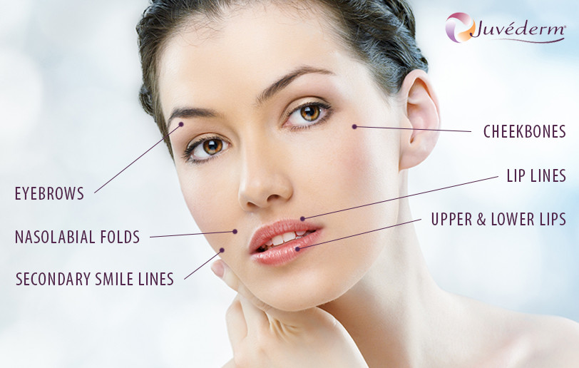 injectables juvederm cda